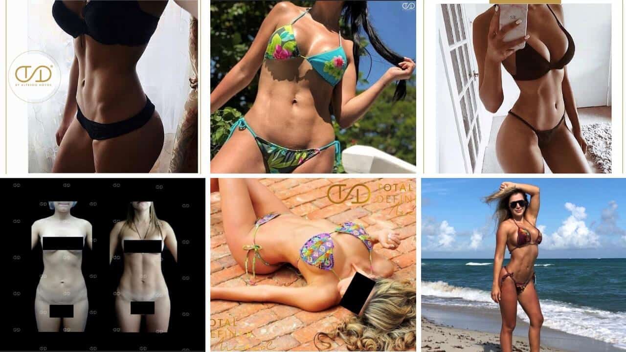 Lipo BetterBody